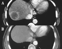 ԭ���Ըΰ��ķ���������