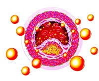 2007��Ѫ֬�о�:һ·�ߵ�����