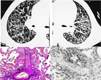 1�����ﻼ�ߵ�����ת��·(��)�����������