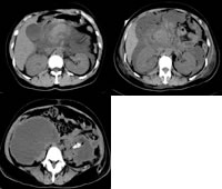 ��֢�����׺ϲ����᳦��һ��