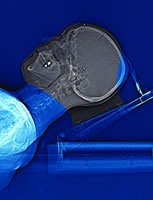 Ԥ����ȫ���������ͷΰ���ת�Ʒ���