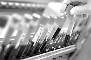 ��Ѫ���緢�ַΰ�