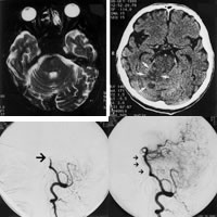 �۽����׶������������ڻ�����ѹ����2008 ESC���������������Ƶ���ʾ