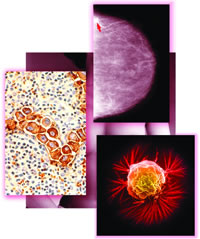 ��NCCN���ٰ��ٴ�ʵ��ָ�ϡ�����