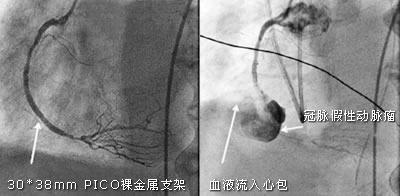 �и�һ������עĿ��֧�ܶ��ѡ�������2008 EuroPCR����֢�᳡�ı���