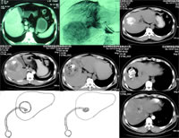 ��ΰ���Ƶ���ڲ���������˼�� �����ΰ��Ƿ�����Ƶ���ڵ�����Ҫ����������ѧ����,���ǰ��״�С