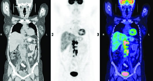 ��NCCN�ǻ�����ܰ����ٴ�ʵ��ָ�ϡ�����