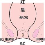 �����������Ƽ�Ԥ������