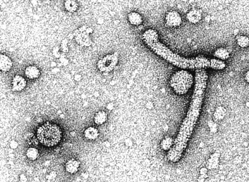 �����Ҹβ��� ��������Ŀ