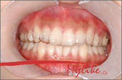 �������ݽ���_�������ݽ���ͻ��