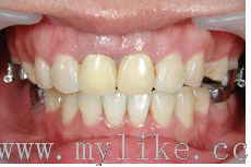 �������ݽ���_�������ݽ���ͻ��