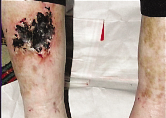 ��������յ�ҩ �����ӽܿ�ѷ֮��˵��ȥ