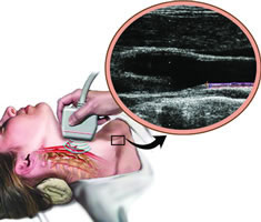 �����޴��Զ����ṹ��⼼��