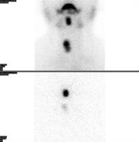 λ״λ״ <sup>99m</sup>Tc<sup>131</sup>Iͬʱһ