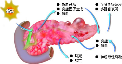 ����SAP�׸������߷塪��������˥�ߵķ���