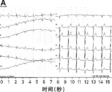 С�о�,���� ת��������TKI����������඾�Թ����Բ�:�Ŷ�����