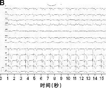 С�о�,���� ת��������TKI����������඾�Թ����Բ�:�Ŷ�����