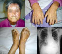 �Ƿβ���������ȫ�����ı���?