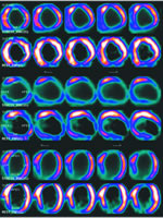 CT-CA+MPI:�������ϳ���ָ�����Ĳ�����