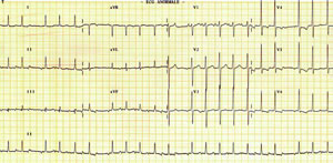 �޹����Դ���ٵı�⼰����