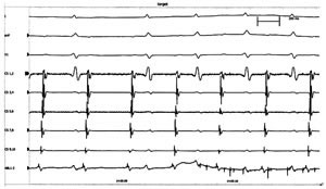 �޹����Դ���ٵı�⼰����