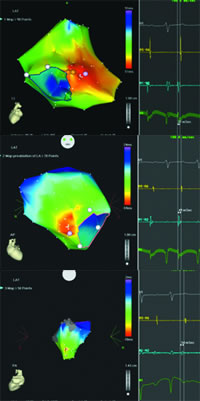 �޹����Դ���ٵı�⼰����