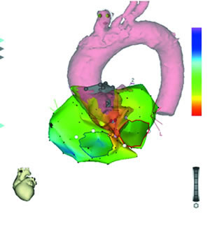 �޹����Դ���ٵı�⼰����