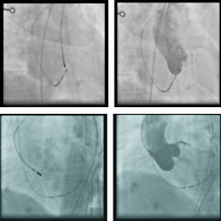 �޹����Դ���ٵı�⼰����