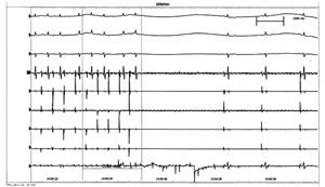 �޹����Դ���ٵı�⼰����