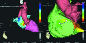 �޹����Դ���ٵı�⼰����