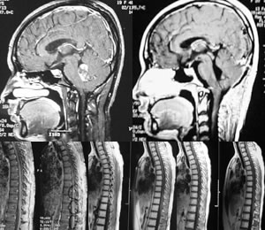 ��ĸϸ����1��