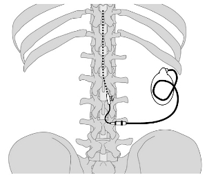 ����ҩ����ע����