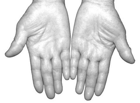 Ӱ�쳤�ٵ���Ҫ����(1)