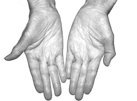 Ӱ�쳤�ٵ���Ҫ����(4)