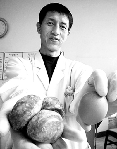 ������ʯͷ����ˣ�ר�Һ�����
