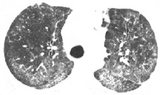 �ط��Է���ά�������Լ����˼��س��