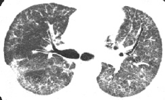 �ط��Է���ά�������Լ����˼��س��