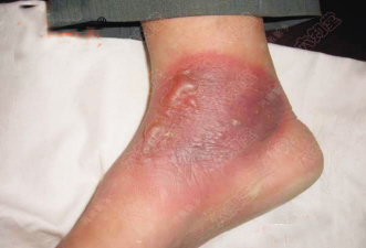 ��������ù�������Ƴ�