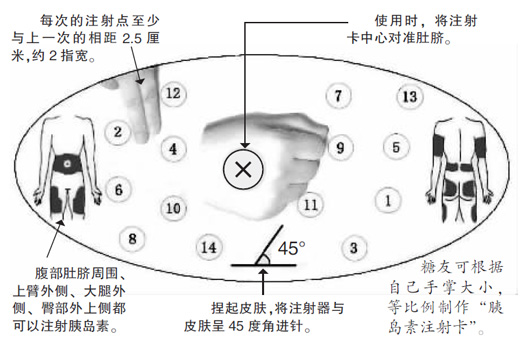 ���������ȵ���ע�俨