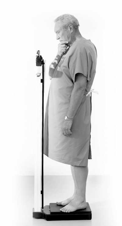 老人营养不良的征兆