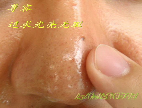 清除鼻子黑头的绝佳窍门(图)