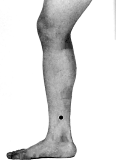 �����Ʒ�����Ӧ֢֮������