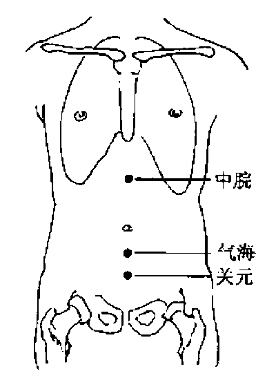 �����Ʒ�����Ӧ֢֮�ڶ�ѣ��֢