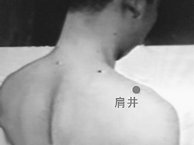 �����Ʒ�����Ӧ֢֮������