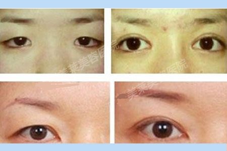 �����´���������Ǯ��