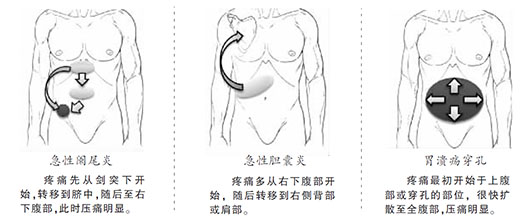 ��������֢����ʹ�й���(ͼ˵����)