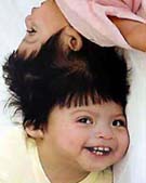 ��ҽ��Ҫ��ͷ��������˫��̥����