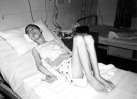 女儿住院才一天竟成植物人 家人索赔近千万