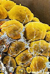 �����ѵ�ԭ����ڣ�(ͼ)