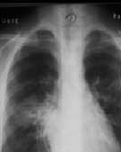 ���ȡ����ԡ���Ѫ��ת������ʹ//